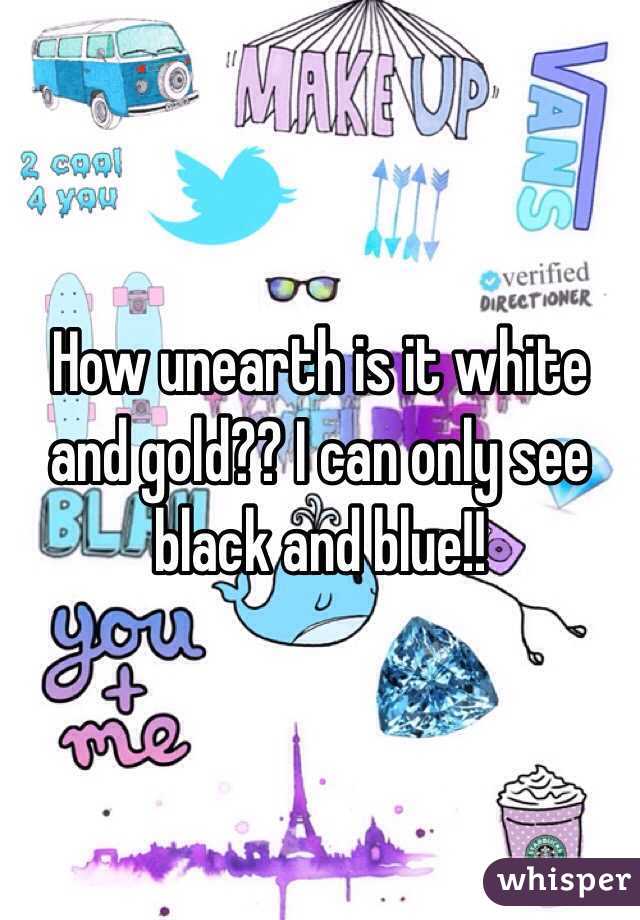 How unearth is it white and gold?? I can only see black and blue!!