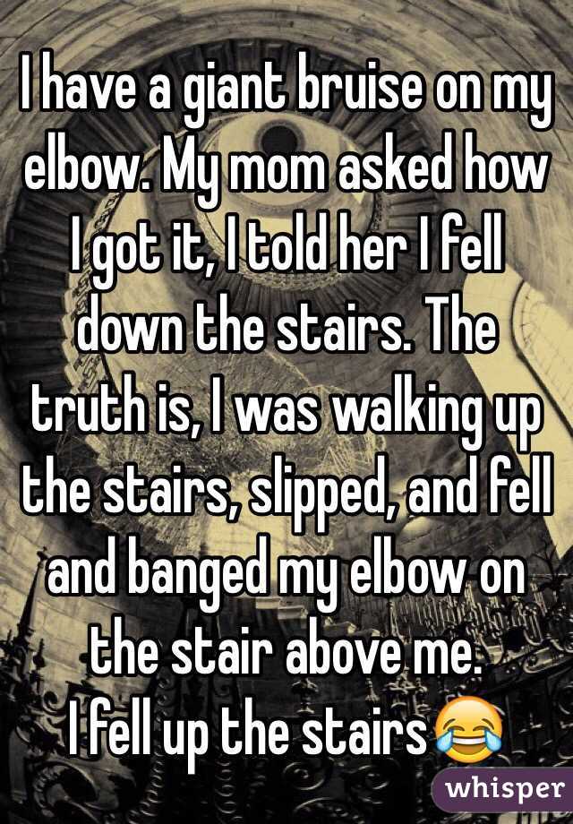 I have a giant bruise on my elbow. My mom asked how I got it, I told her I fell down the stairs. The truth is, I was walking up the stairs, slipped, and fell and banged my elbow on the stair above me. 
I fell up the stairs😂