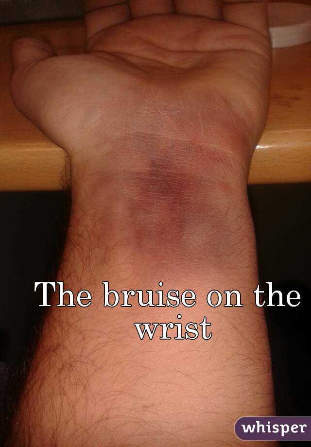 The bruise on the wrist
