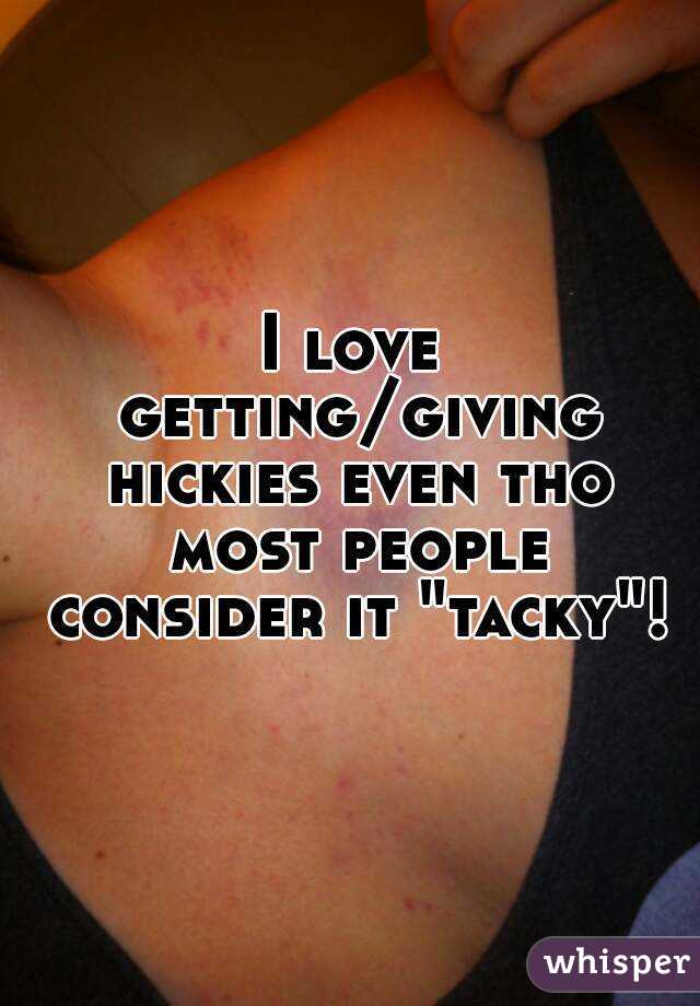 I love getting/giving hickies even tho most people consider it "tacky"!