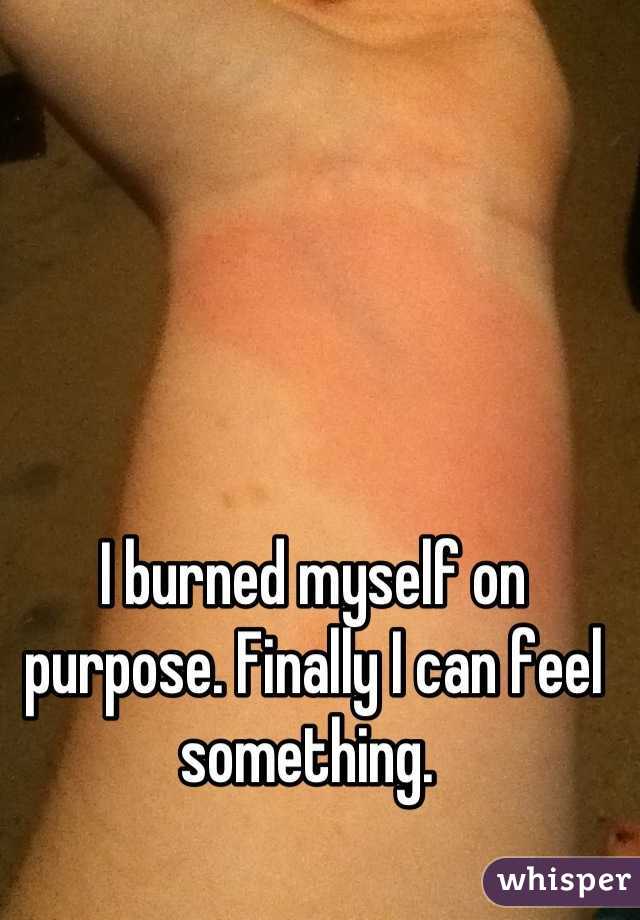 I burned myself on purpose. Finally I can feel something. 
