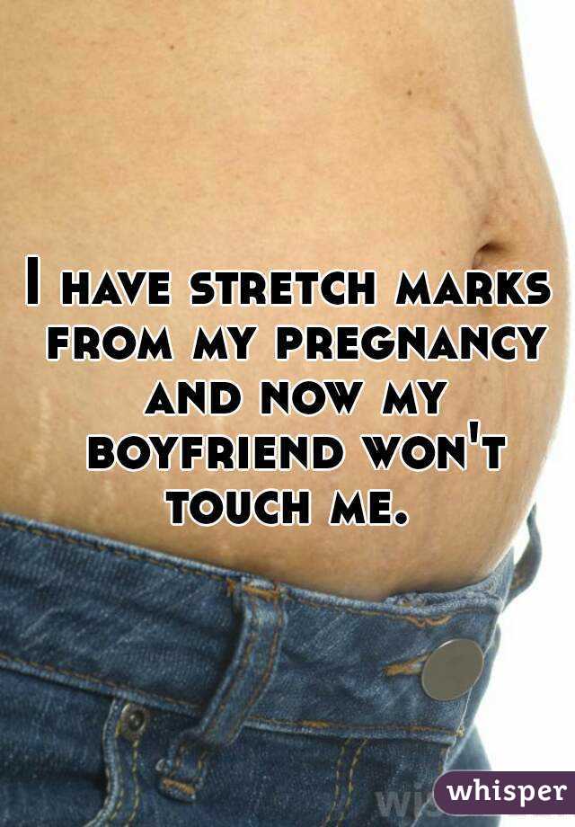 I have stretch marks from my pregnancy and now my boyfriend won't touch me. 