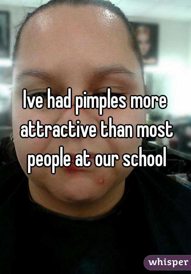 Ive had pimples more attractive than most people at our school