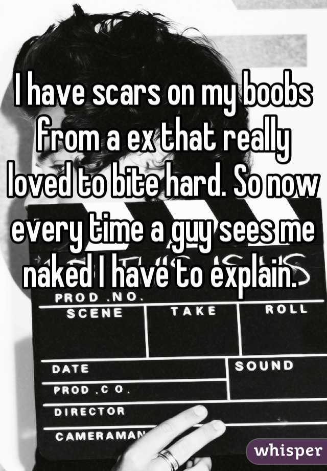 I have scars on my boobs from a ex that really loved to bite hard. So now every time a guy sees me naked I have to explain. 