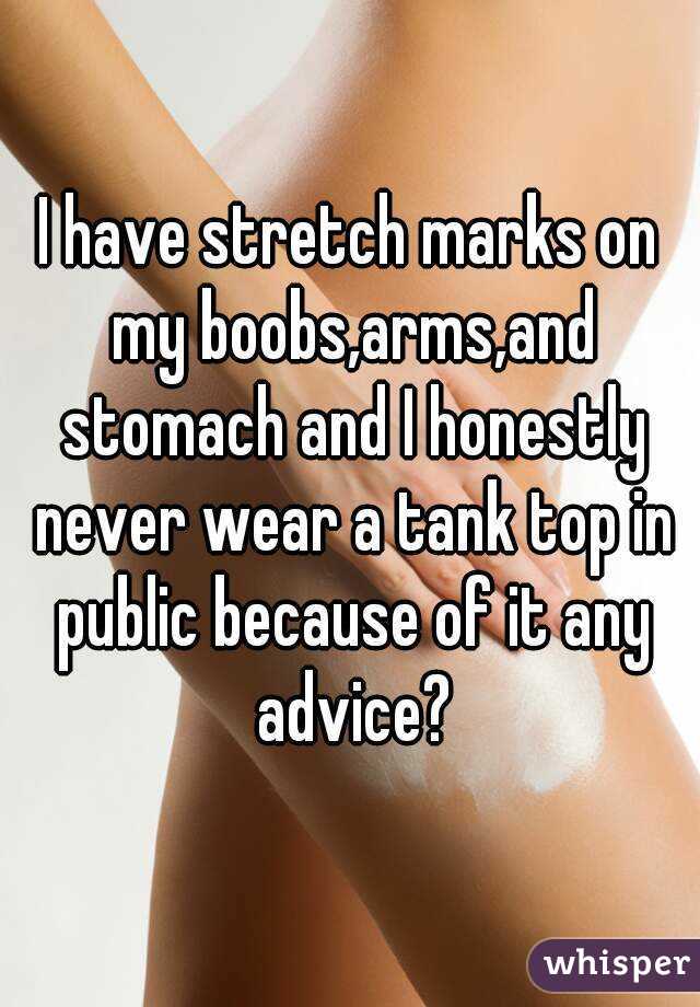 I have stretch marks on my boobs,arms,and stomach and I honestly never wear a tank top in public because of it any advice?