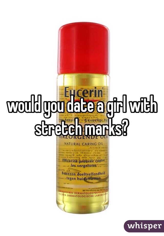 would you date a girl with stretch marks?