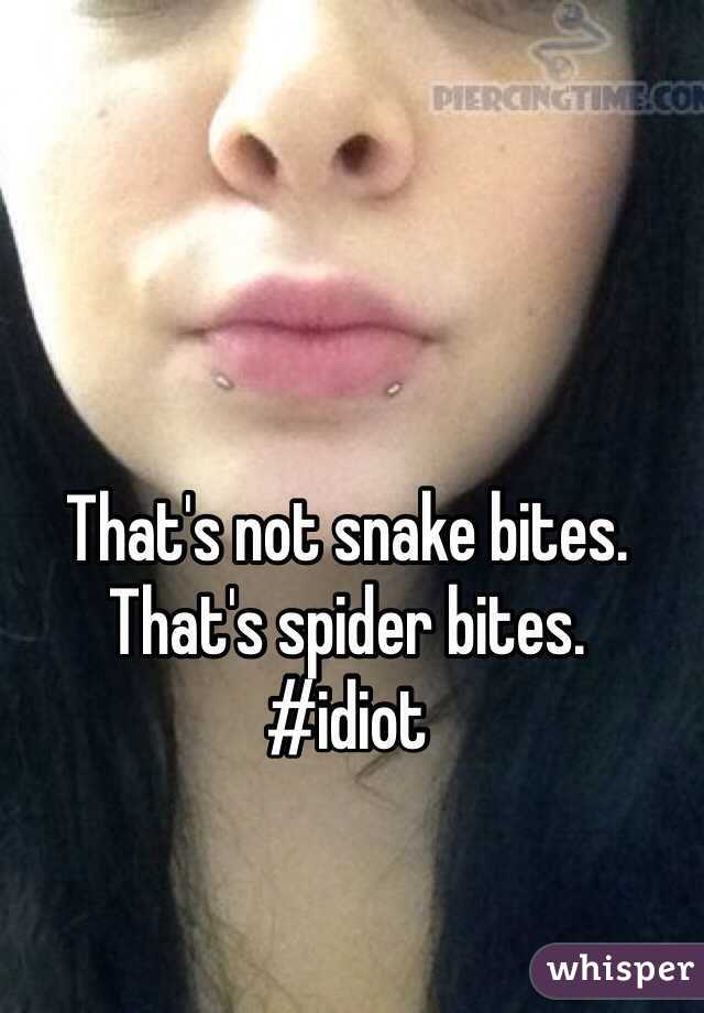 That's not snake bites. That's spider bites. 
#idiot