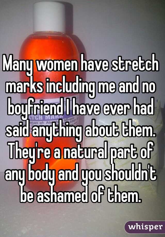 Many women have stretch marks including me and no boyfriend I have ever had said anything about them. They're a natural part of any body and you shouldn't be ashamed of them.