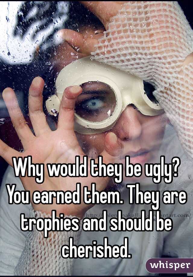 Why would they be ugly? You earned them. They are trophies and should be cherished.