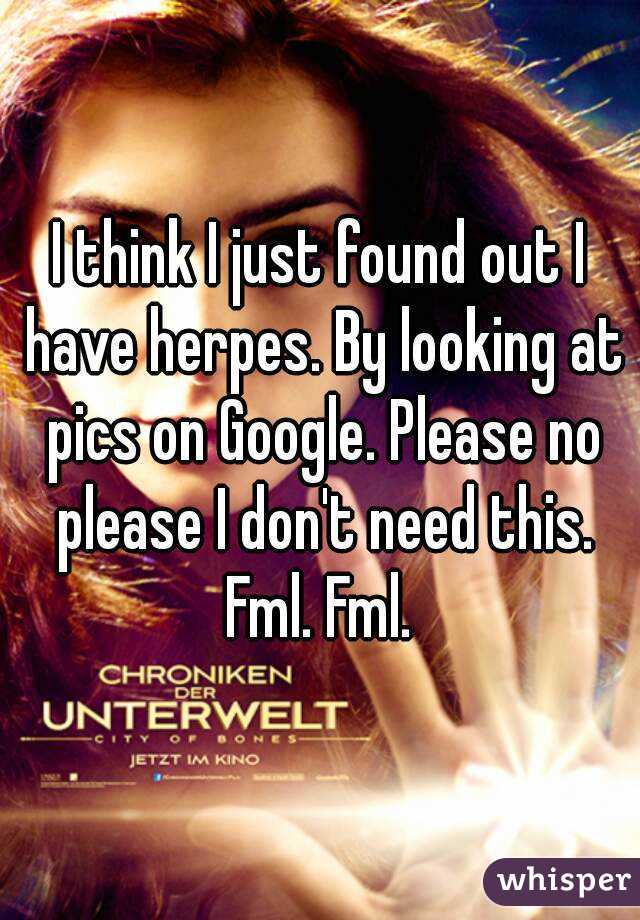 I think I just found out I have herpes. By looking at pics on Google. Please no please I don't need this. Fml. Fml. 