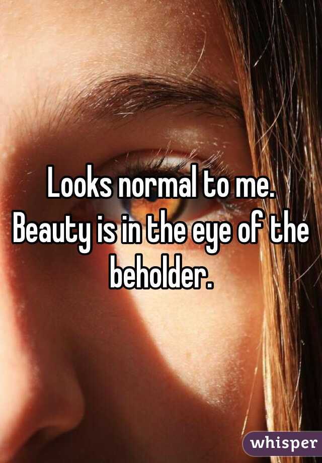 Looks normal to me. Beauty is in the eye of the beholder.