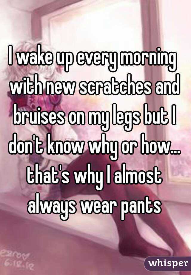 I wake up every morning with new scratches and bruises on my legs but I don't know why or how... that's why I almost always wear pants