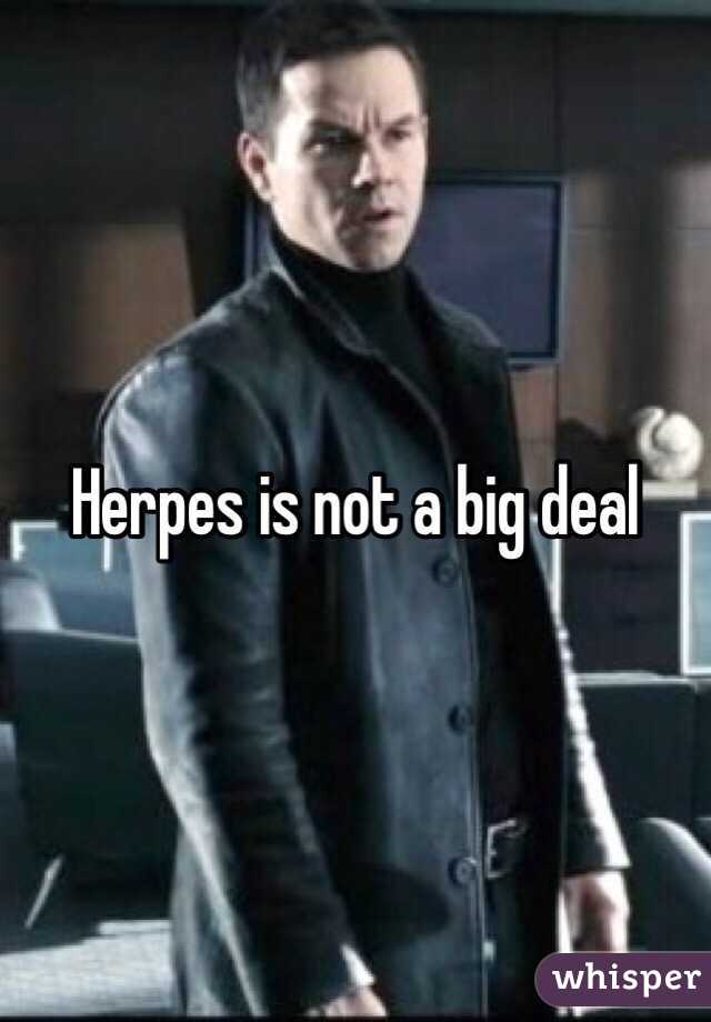 Herpes is not a big deal 