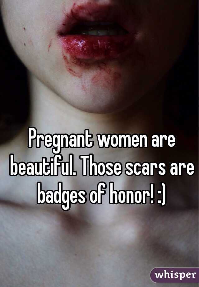 Pregnant women are beautiful. Those scars are badges of honor! :)