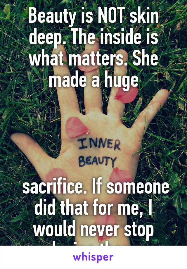 Beauty is NOT skin deep. The inside is what matters. She made a huge




 sacrifice. If someone did that for me, I would never stop loving them