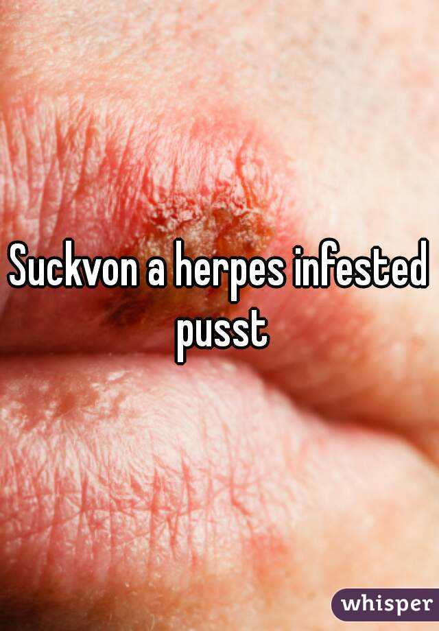 Suckvon a herpes infested pusst