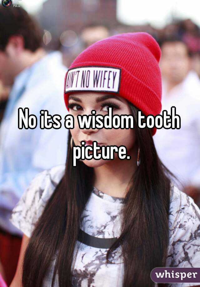 No its a wisdom tooth picture.