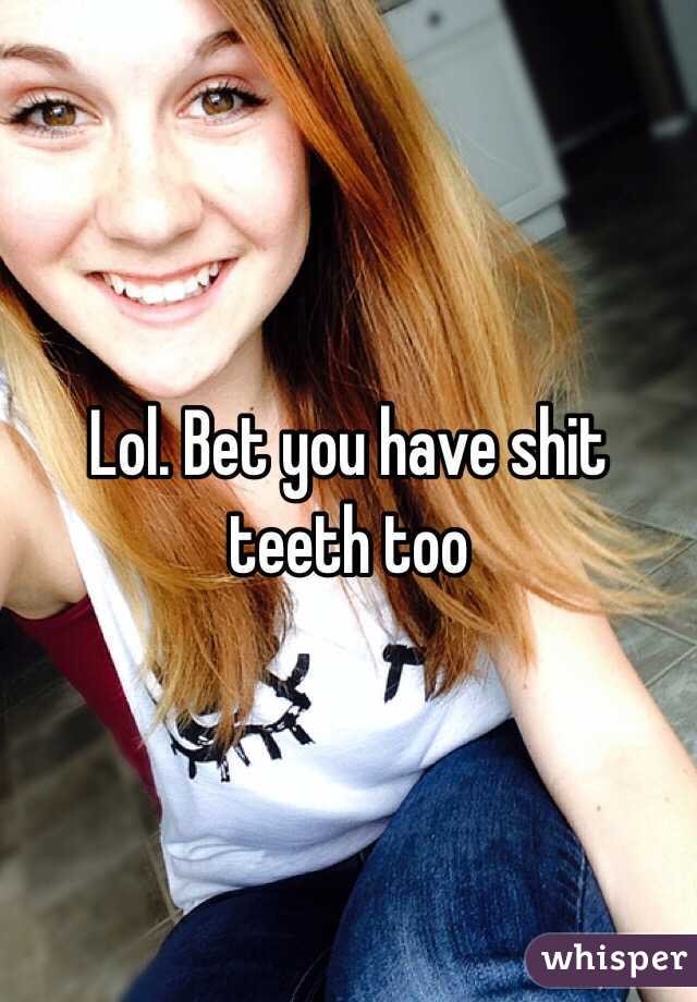 Lol. Bet you have shit teeth too 