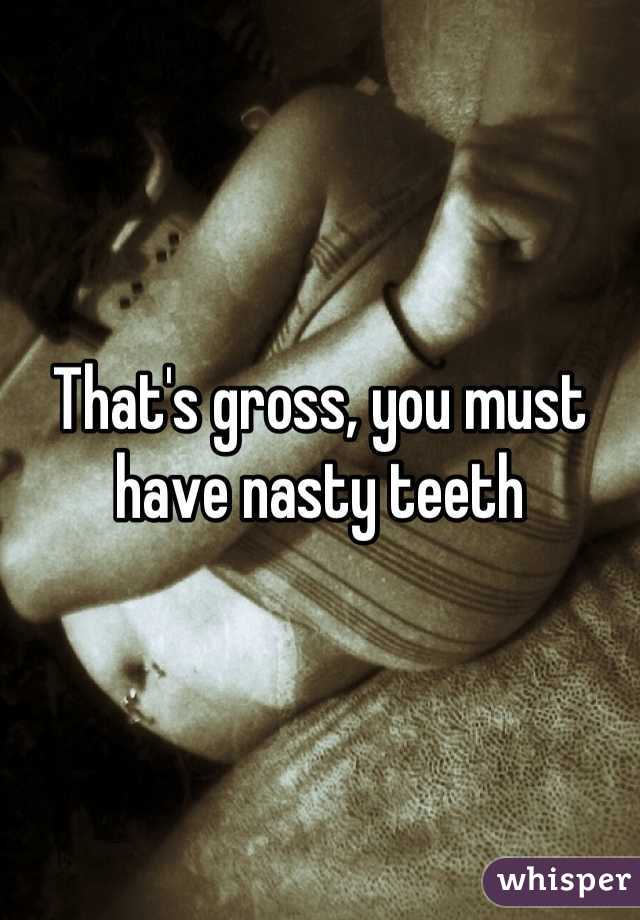 That's gross, you must have nasty teeth