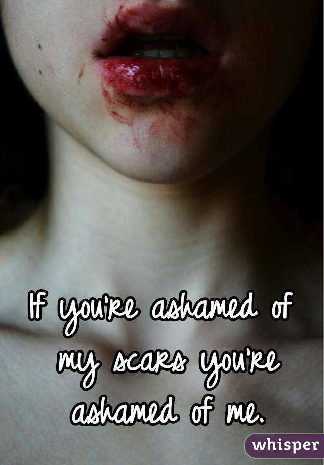 If you're ashamed of my scars you're ashamed of me.