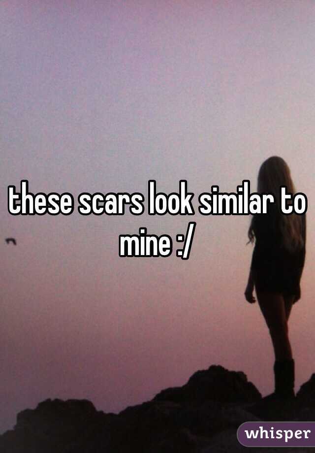 these scars look similar to mine :/ 