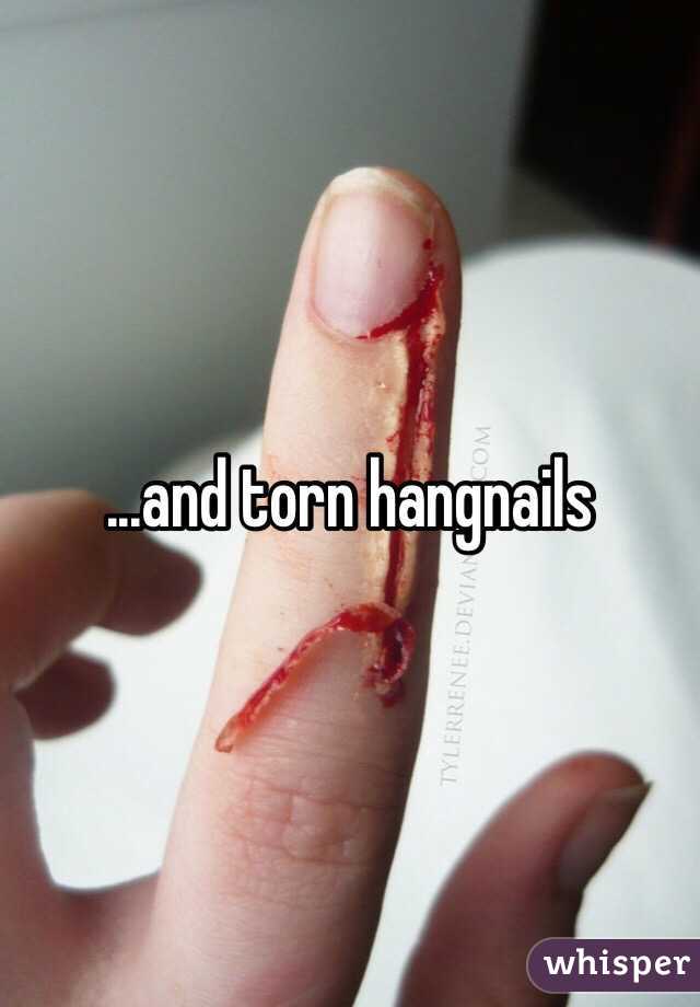 ...and torn hangnails