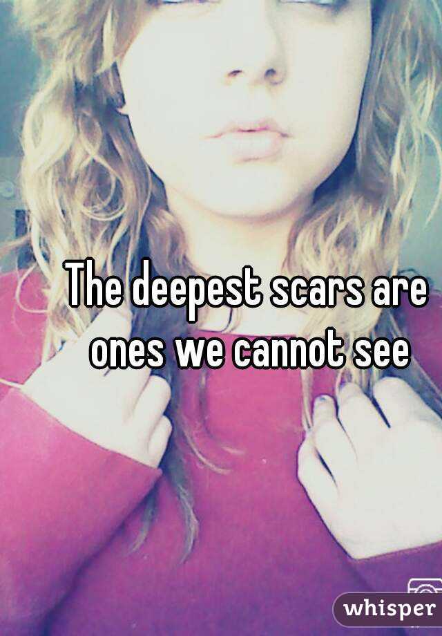 The deepest scars are ones we cannot see