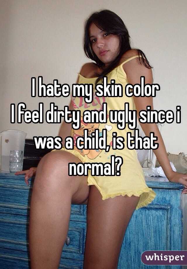 I hate my skin color 
I feel dirty and ugly since i was a child, is that normal? 