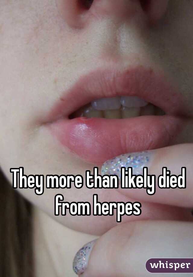 They more than likely died from herpes