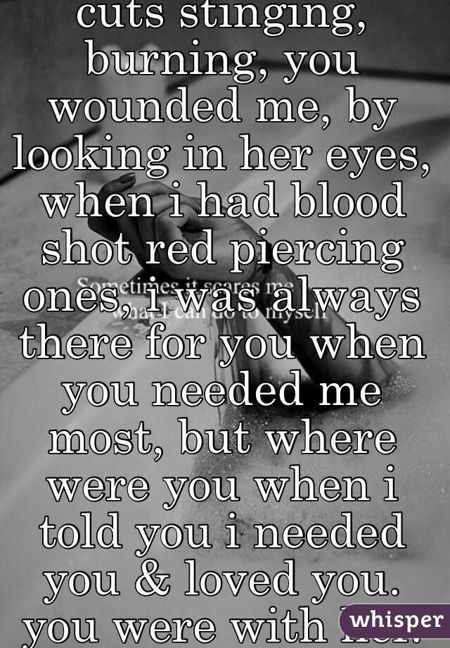 cuts stinging, burning, you wounded me, by looking in her eyes, when i had blood shot red piercing ones, i was always there for you when you needed me most, but where were you when i told you i needed you & loved you. you were with her.