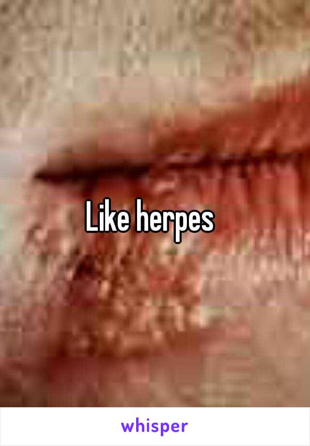 Like herpes