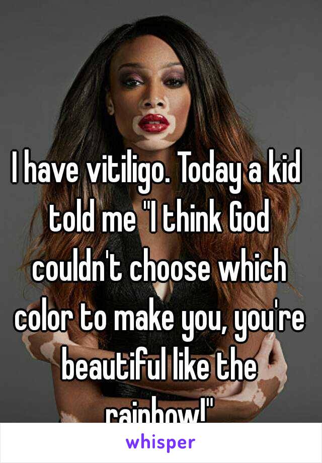 I have vitiligo. Today a kid told me "I think God couldn't choose which color to make you, you're beautiful like the rainbow!"