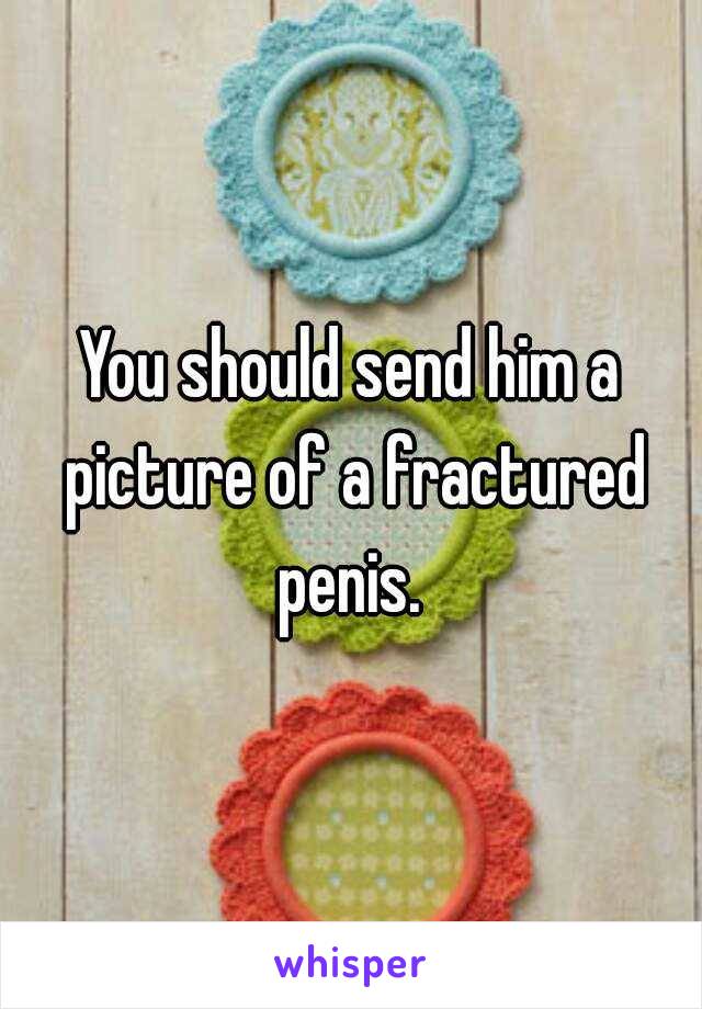 You should send him a picture of a fractured penis. 