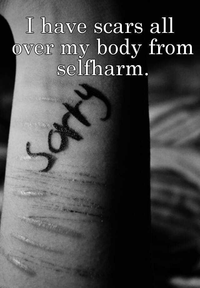 i-have-scars-all-over-my-body-from-selfharm