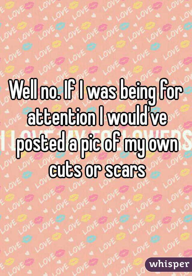 Well no. If I was being for attention I would've posted a pic of my own cuts or scars