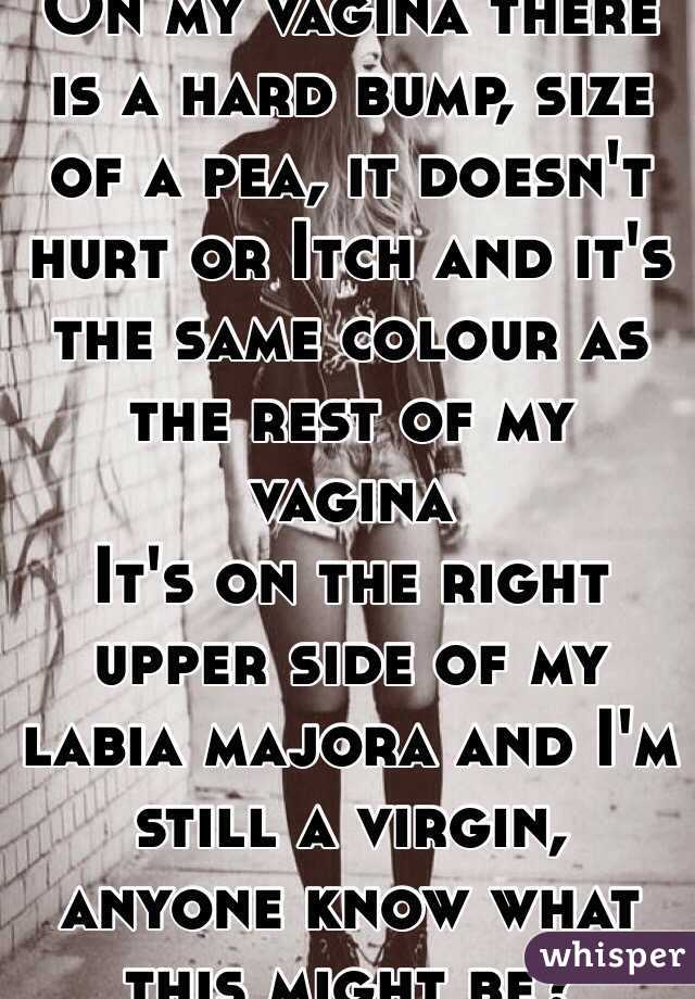 On my vagina there is a hard bump, size of a pea, it doesn't hurt or Itch and it's the same colour as the rest of my vagina
It's on the right upper side of my labia majora and I'm still a virgin, anyone know what this might be?