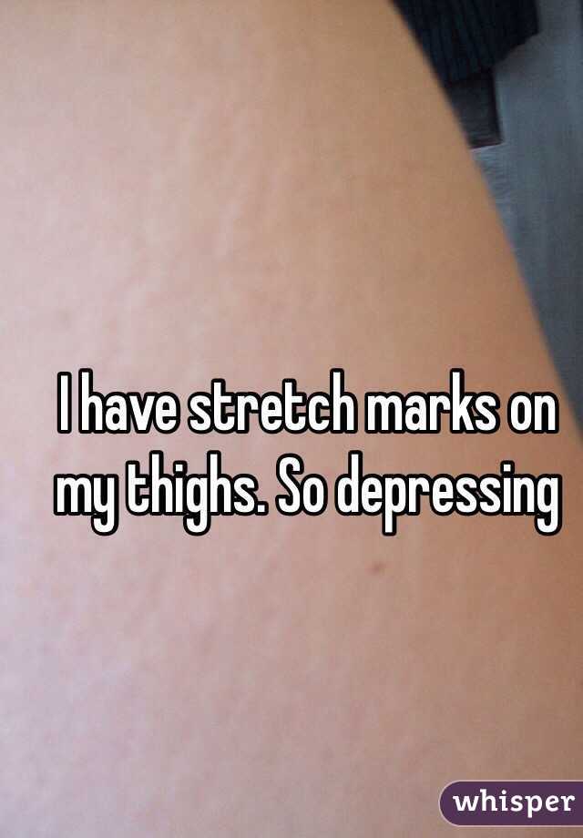 I have stretch marks on my thighs. So depressing 