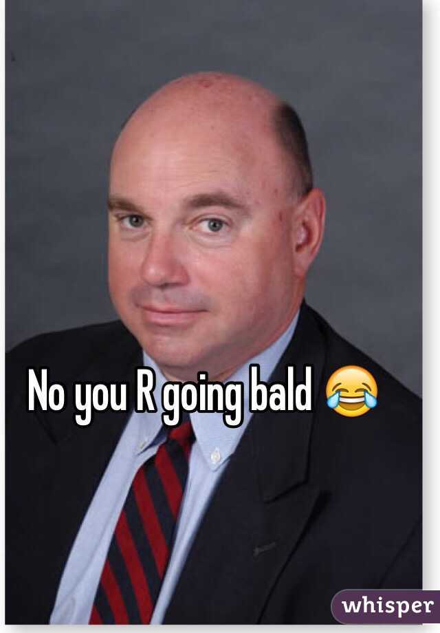 No you R going bald 😂