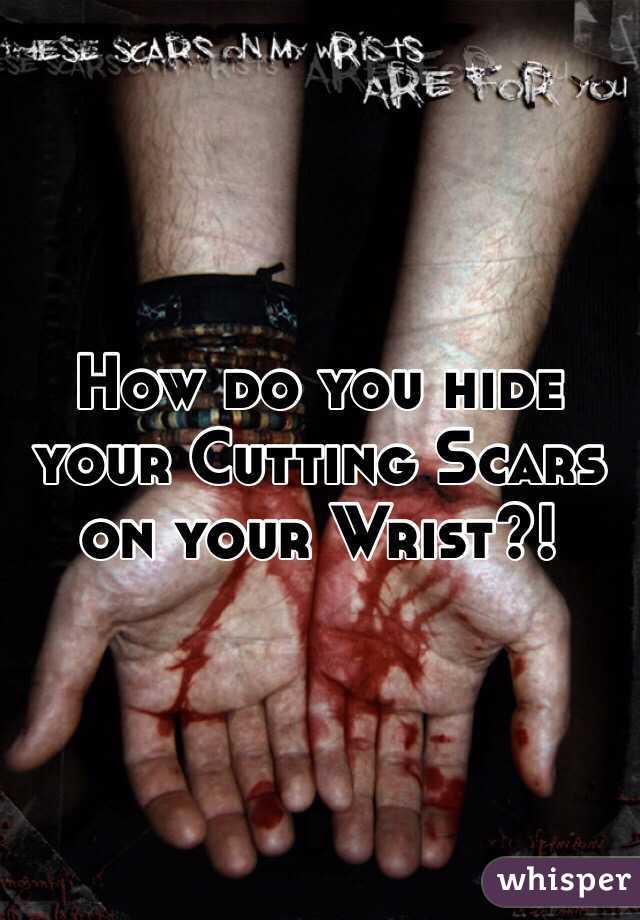 How do you hide your Cutting Scars on your Wrist?!
