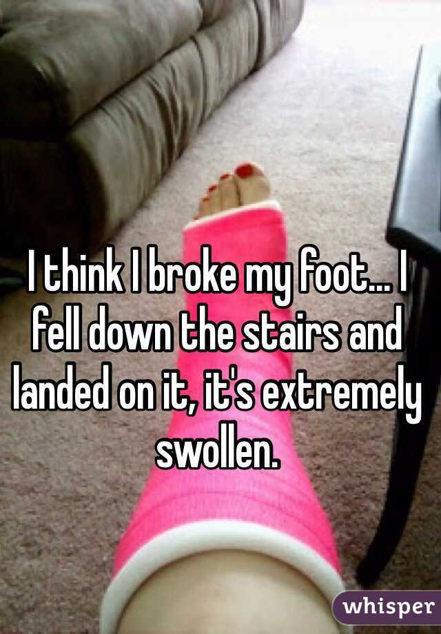 I think I broke my foot... I fell down the stairs and landed on it, it's extremely swollen.
