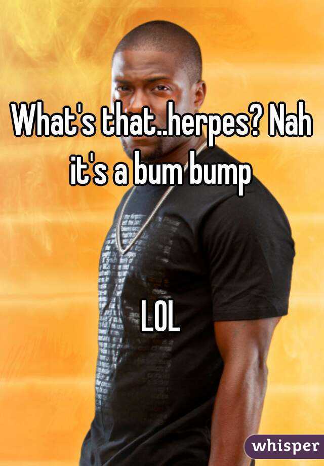 What's that..herpes? Nah it's a bum bump 


LOL