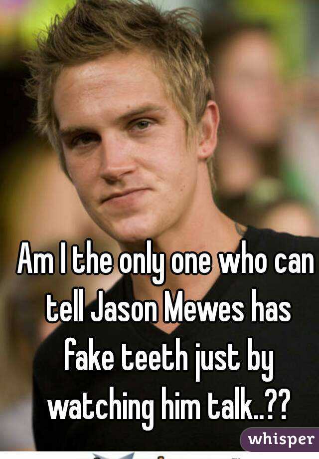 Am I the only one who can tell Jason Mewes has fake teeth just by watching him talk..??