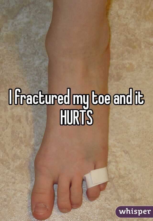 I fractured my toe and it HURTS