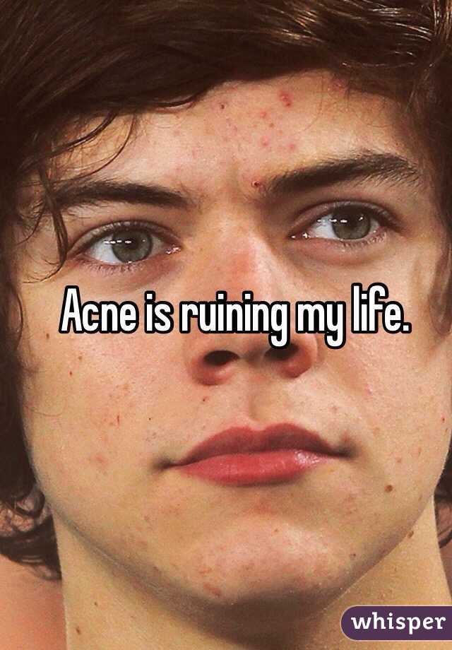 Acne is ruining my life.