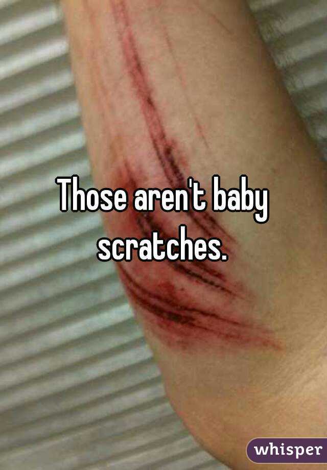 Those aren't baby scratches. 