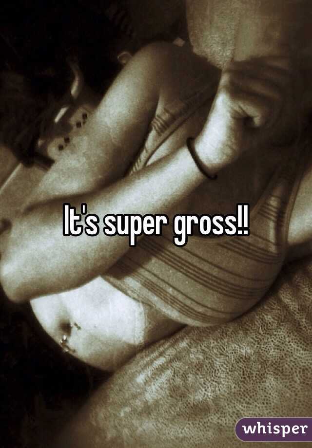 It's super gross!!