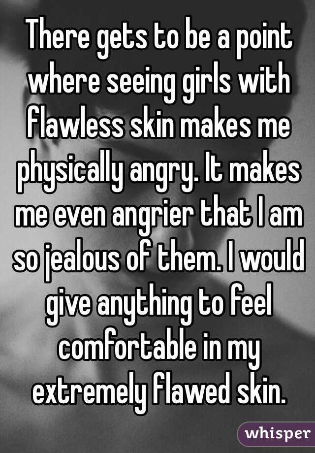 There gets to be a point where seeing girls with flawless skin makes me physically angry. It makes me even angrier that I am so jealous of them. I would give anything to feel comfortable in my extremely flawed skin.