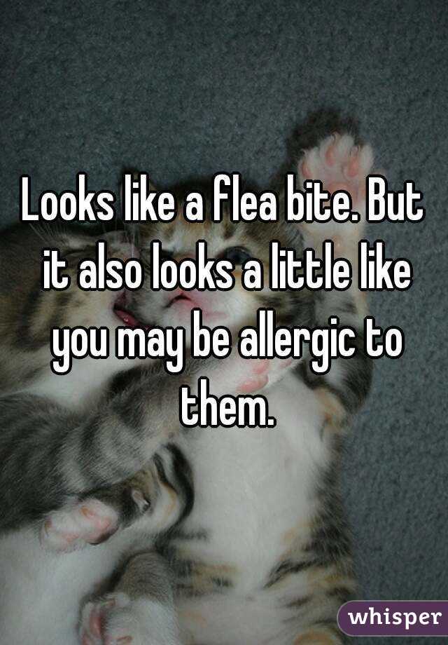 Looks like a flea bite. But it also looks a little like you may be allergic to them.