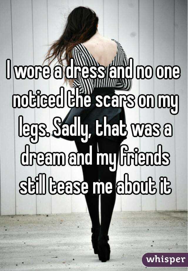 I wore a dress and no one noticed the scars on my legs. Sadly, that was a dream and my friends still tease me about it