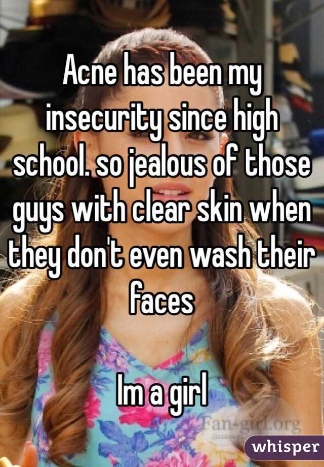 Acne has been my insecurity since high school. so jealous of those guys with clear skin when they don't even wash their faces

Im a girl